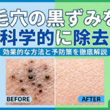 毛穴の黒ずみを科学的に除去。効果的な方法と予防策を徹底解説。
