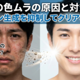 男性の色ムラの原因と対策は？メラニン生成を抑制してクリアな肌へ。